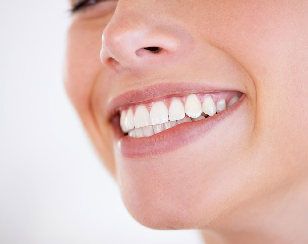Kvinna som ler stort med vita tänder
